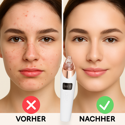 PoreLuxe Elegant & hochwertig – klingt direkt nach effektiver Hautpflege