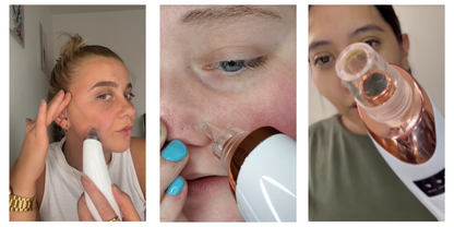 PoreLuxe Elegant & hochwertig – klingt direkt nach effektiver Hautpflege